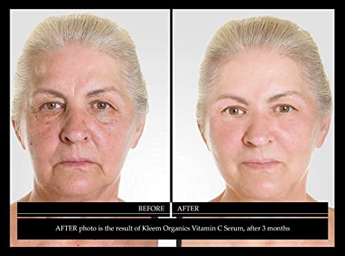 Анти Стареењето Лице Пакет: Витамин Ц Серум за Лице &засилувач; Ретинол Крем За Лице-Природни &засилувач; Органски Подарок Во